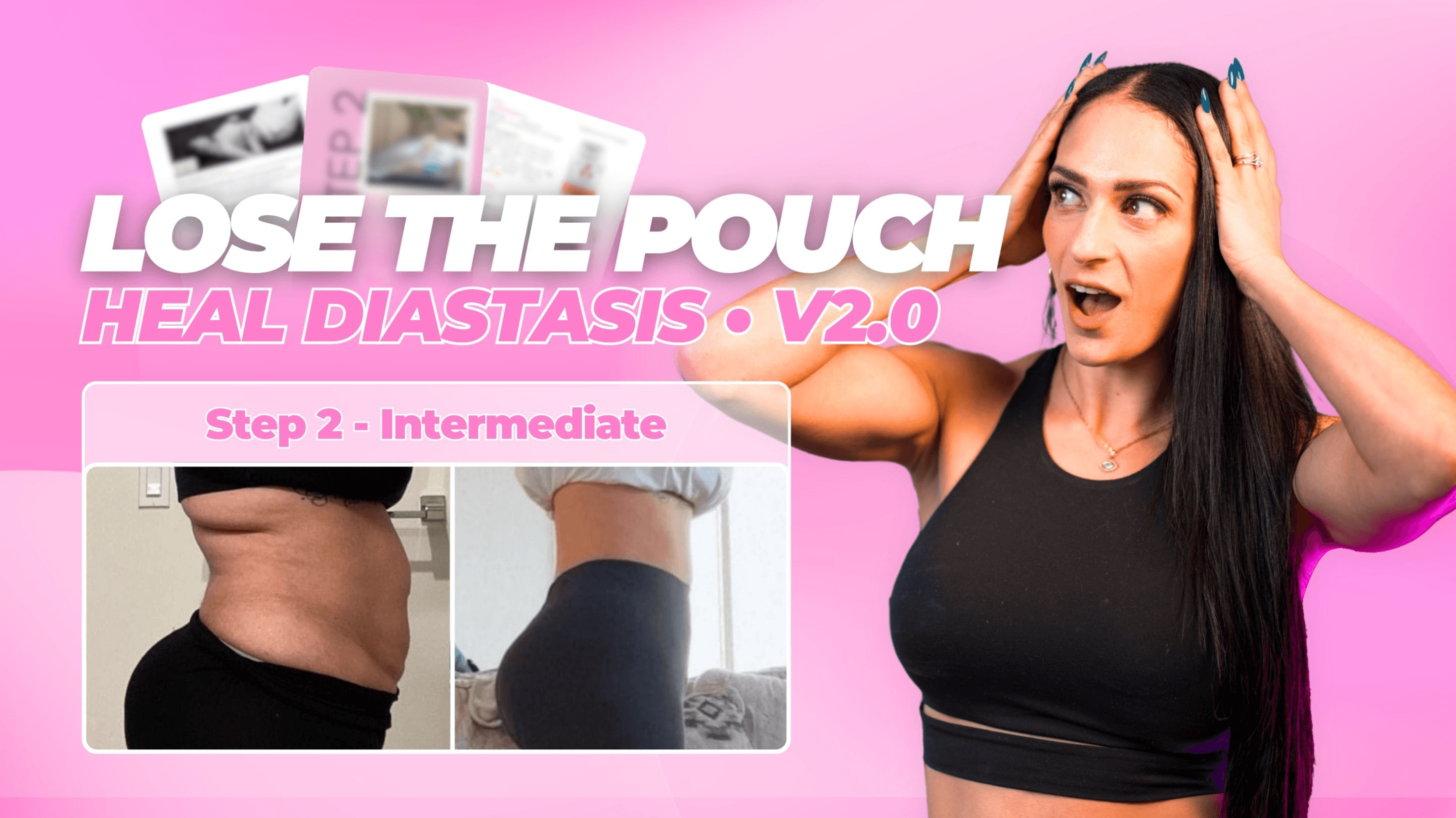 STEP 2 – Diastasis (2 cm and - ) V2