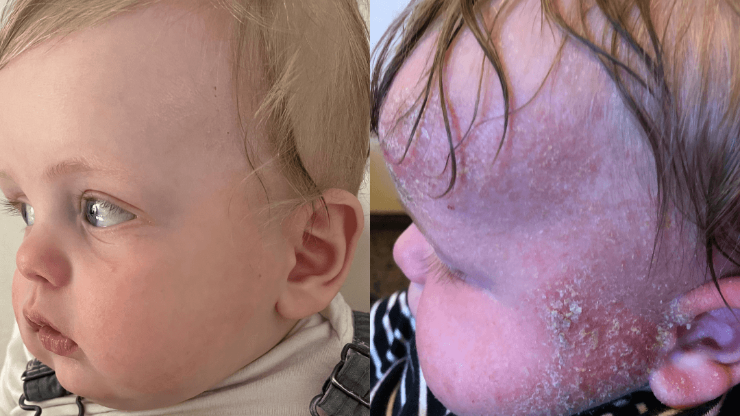 Skin & Food Allergies Guide
