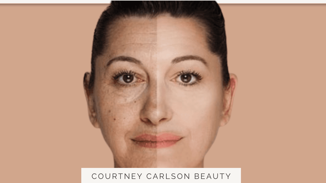 The Secret to Reversing Hyperpigmentation Guide.