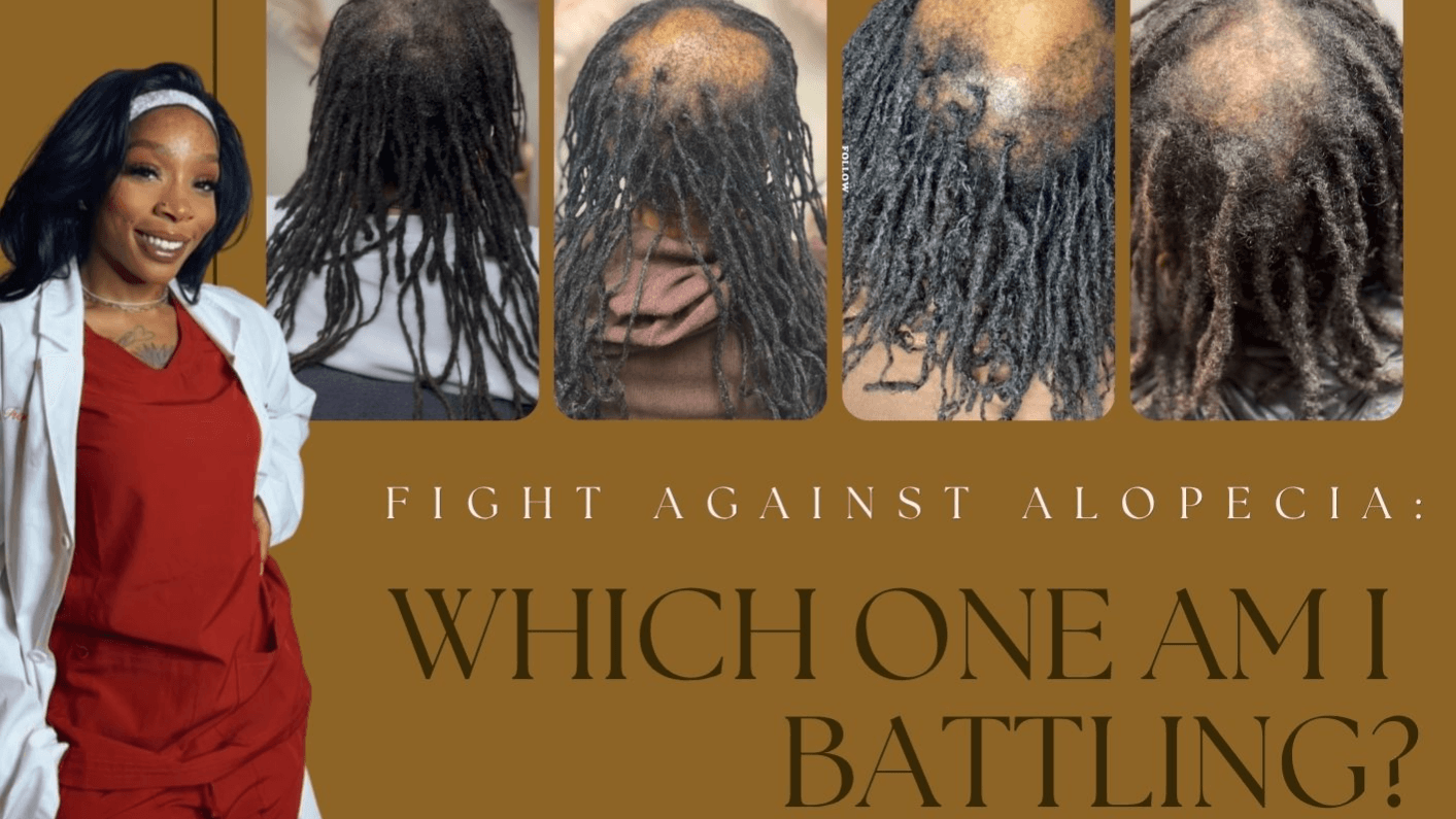 Fight Against Alopecia: Which One Am I Battling?