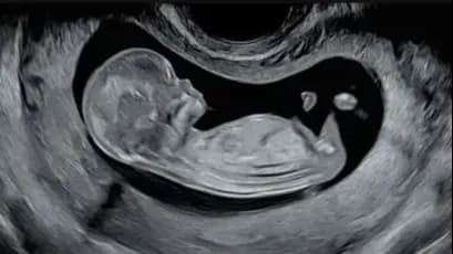 Free Workshop: 1st Scan in Pregnancy