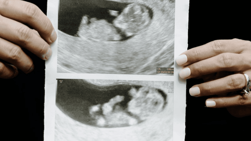 Free Workshop: 20 Week Scan: All you NEED to know!