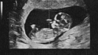 Free Workshop: 20 Week Scan: All you NEED to know!