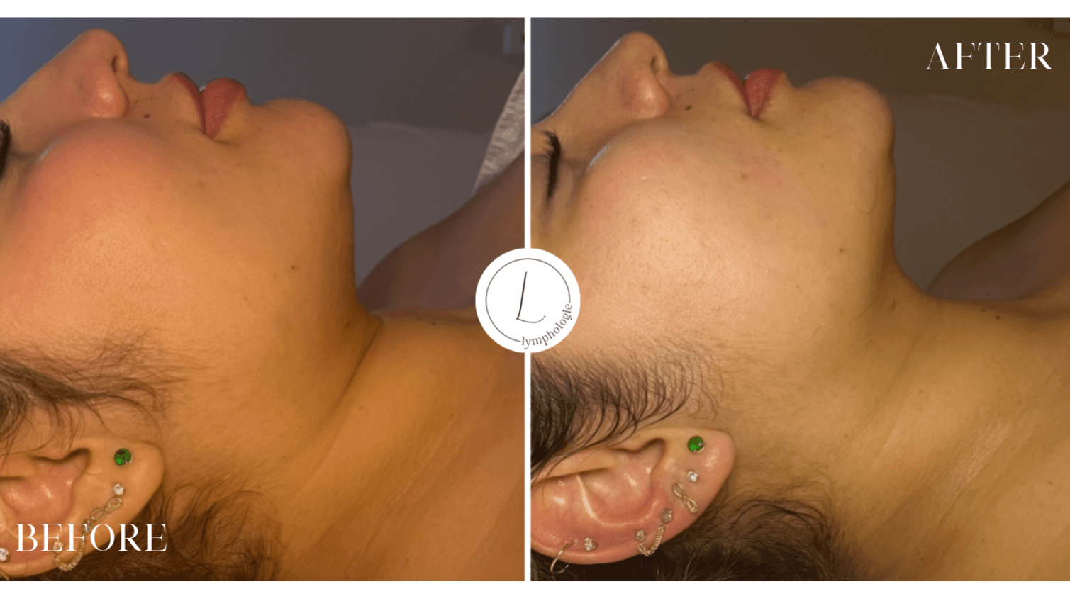 Facial Brazilian Lymphatic Drainage Certification