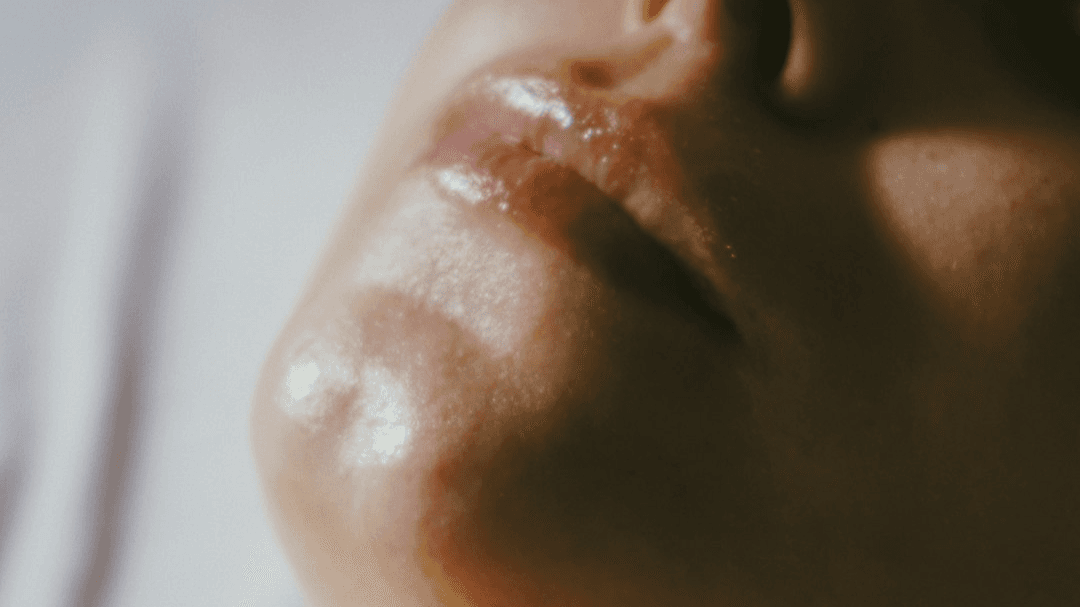 Chemical Peel Course