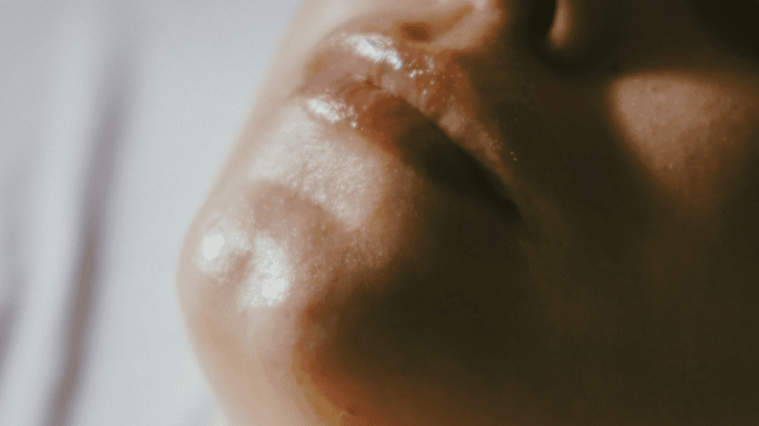 Complete Foundation & Advanced Injectable Course