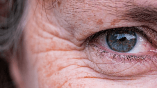 Age + Renew Luxe: Premium Renewal Routine