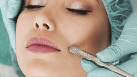 Get My Microneedling Guide Now!