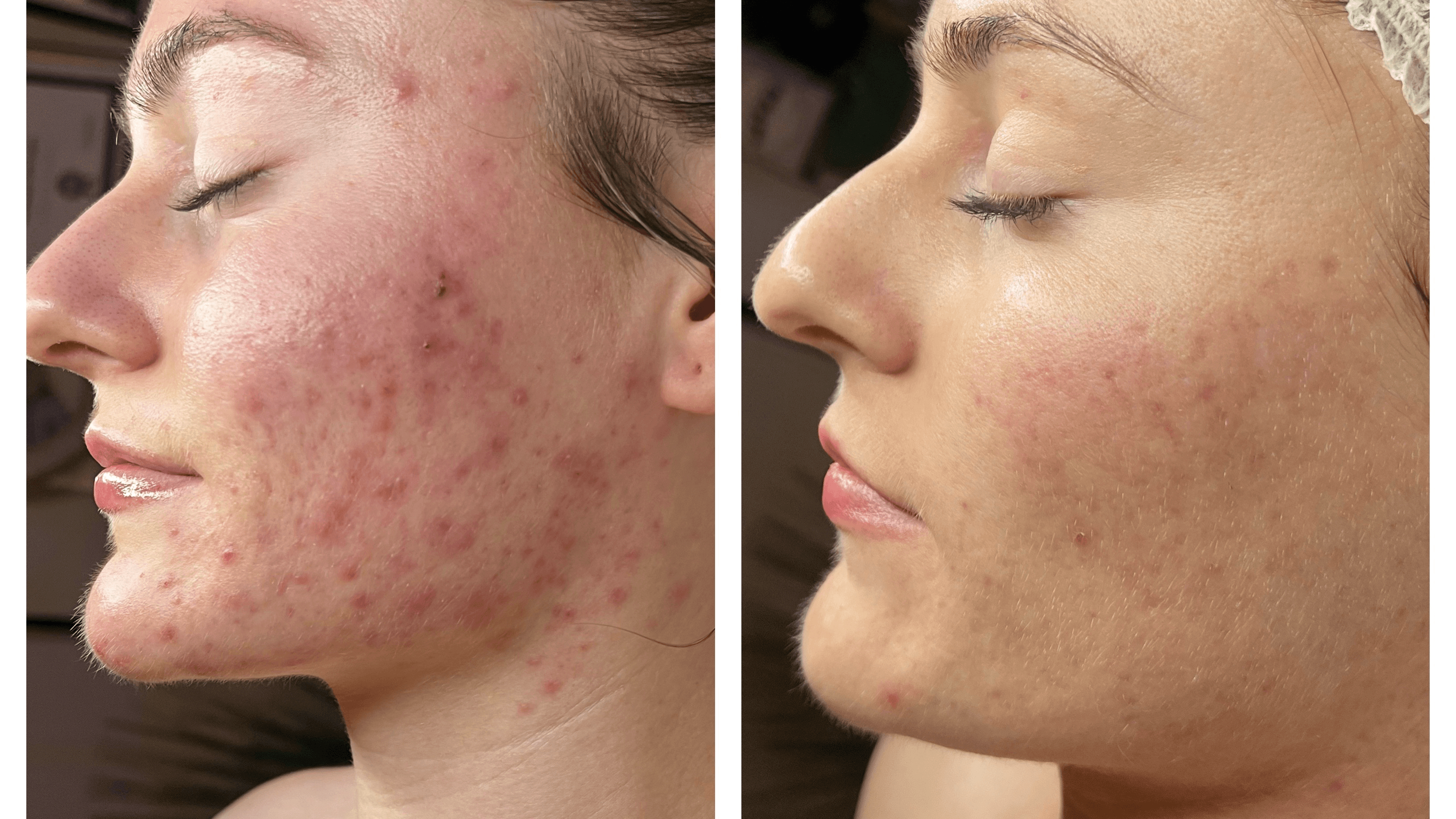 Clear Skin Reset Guide