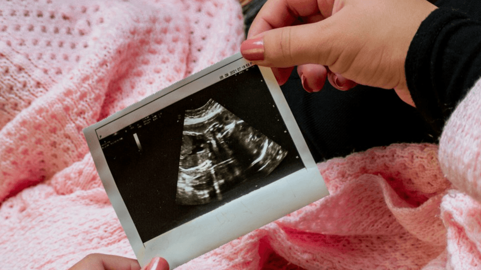 My Pregnancy Journal