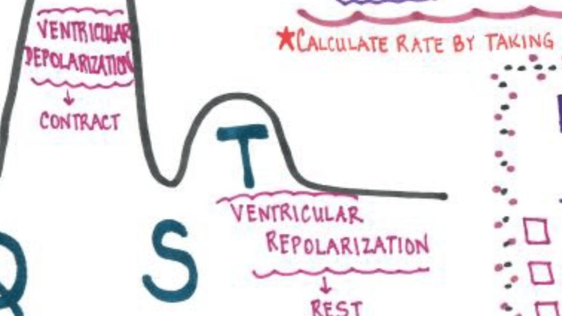 EKG Cheat Sheet Bundle