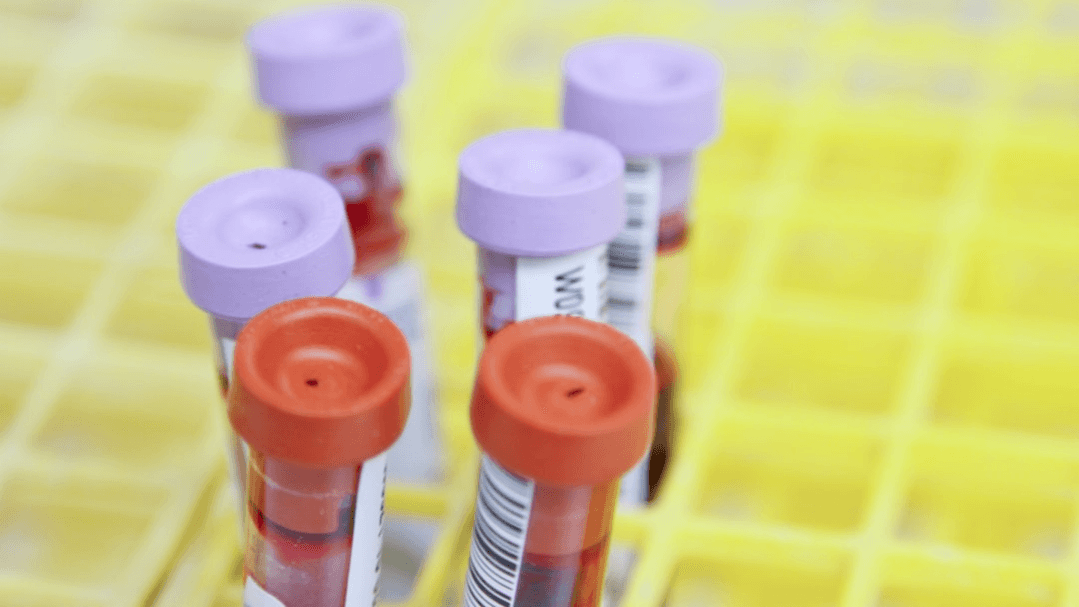 FREE! 5 Labs to Ask Your Provider About 