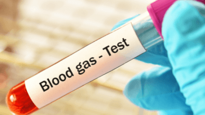 ABG Interpretation | Full Guide