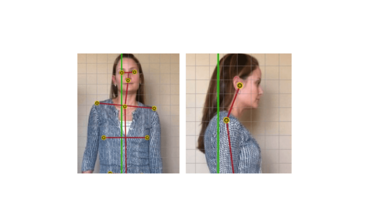 Personalized Posture Pattern Assessment