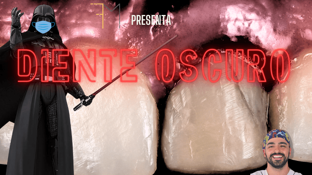 Tratamiento integral del diente oscuro