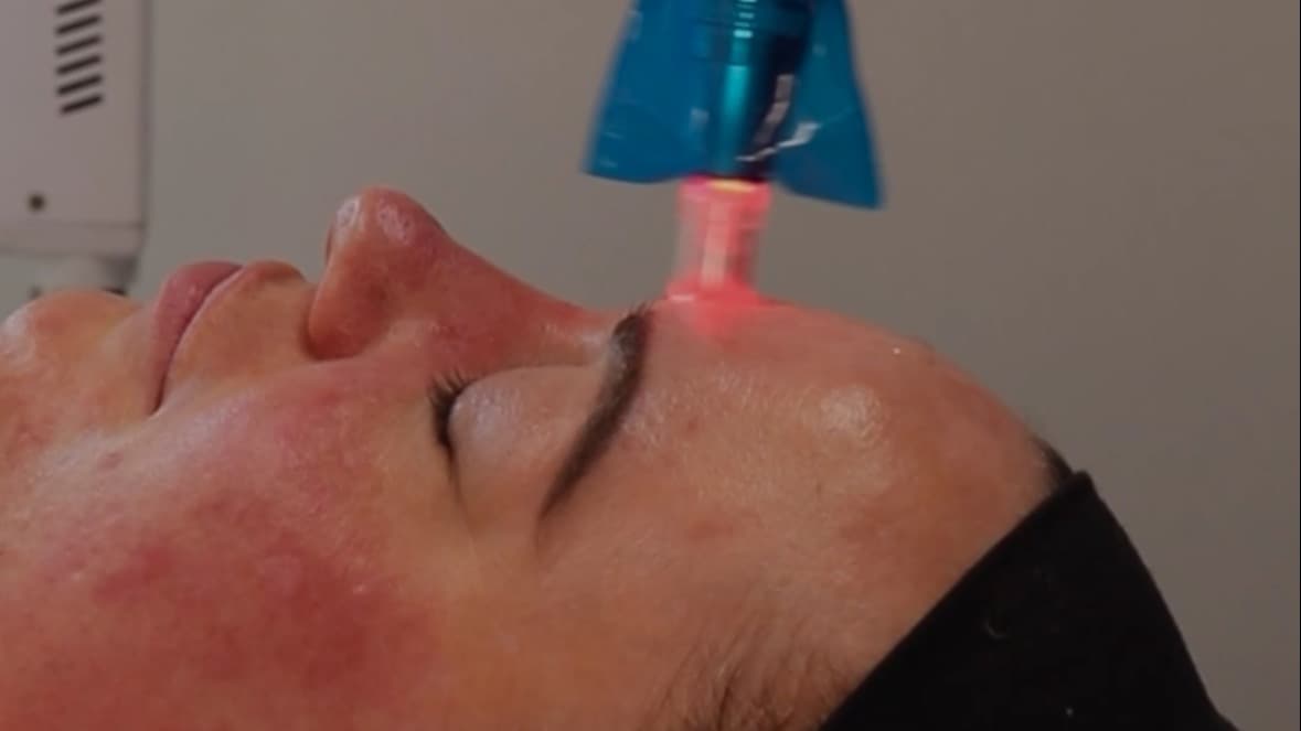 Microneedling class with Jodi