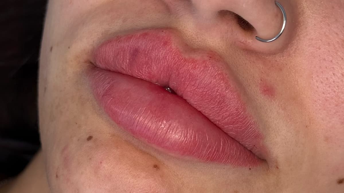 2026 Edition: 3D-Sculpt Lip Masterclass | Online