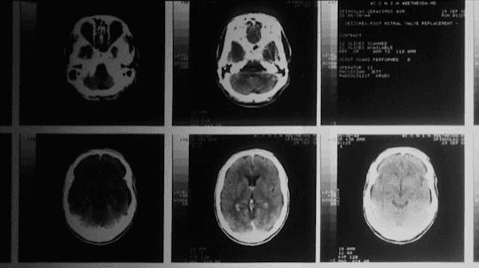 Trace Neuro Basic Brain Map