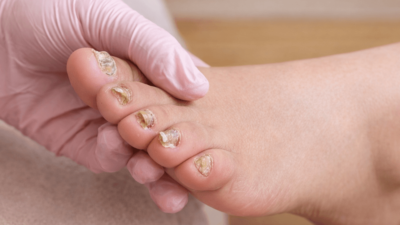 Start Here: What's Really Going On With Your Nails