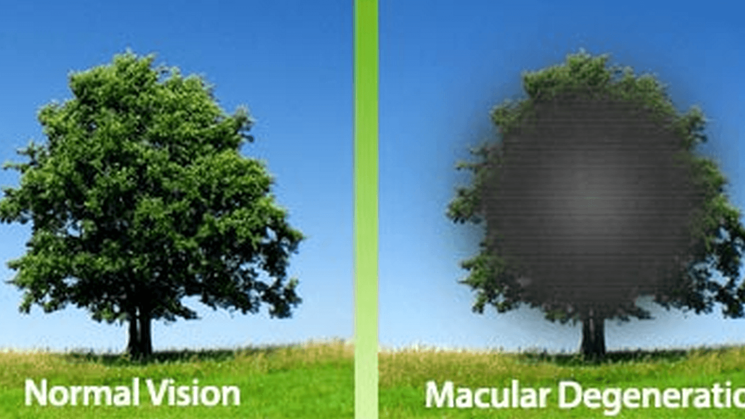 Learn How To Safely and Naturally Save Your Sight