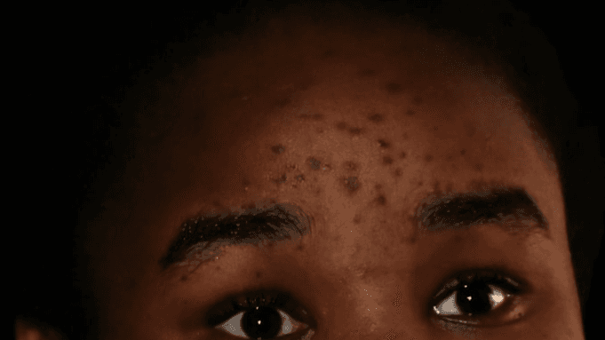 Bright + Even: Dark Spot + Tone Routine
