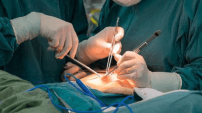Appendectomy Masterclass + Presentation