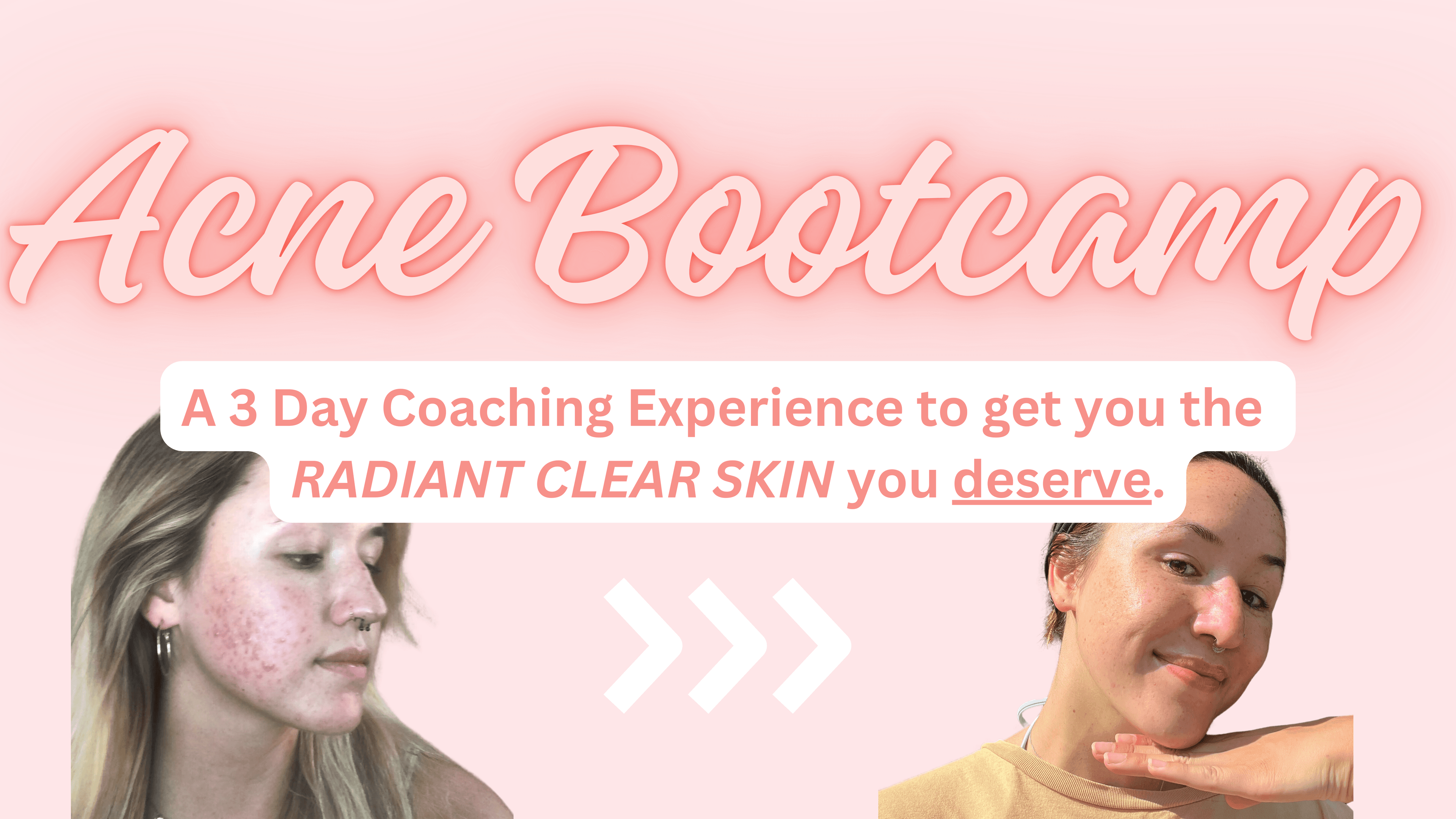 Get the RADIANT CLEAR SKIN you freaking deserve...